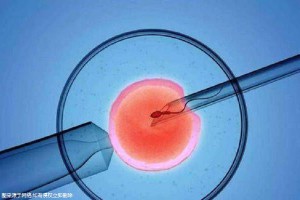 三代试管供卵代怀